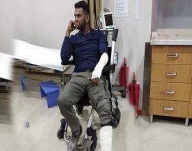 Hero Vishal Got Injured in Turkey